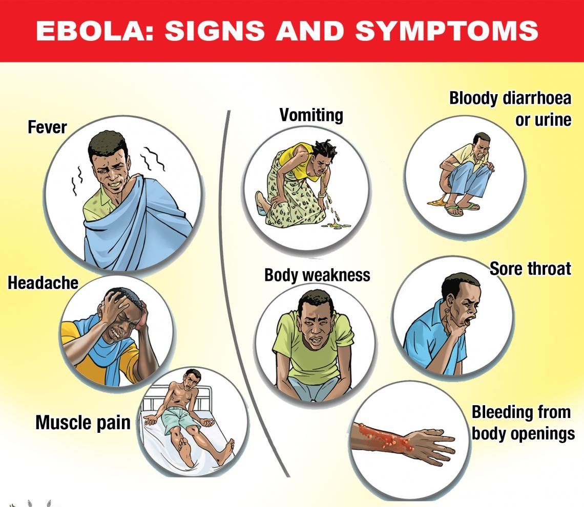 signs and symptoms of ebola